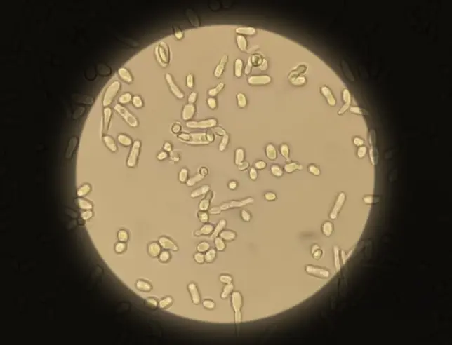 Imagem microscópica de células de levedura visíveis num campo circular iluminado, sobre fundo escuro.